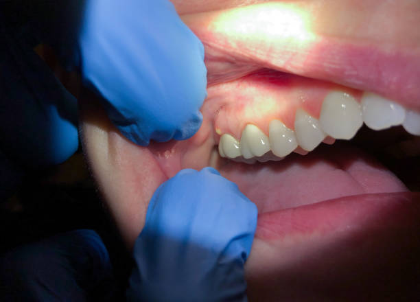 Best Same-Day Emergency Dentist in Double Springs, AL