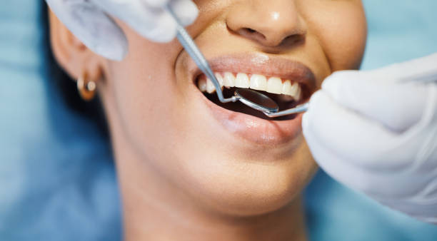 Best Emergency Treatment for Toothache in Double Springs, AL